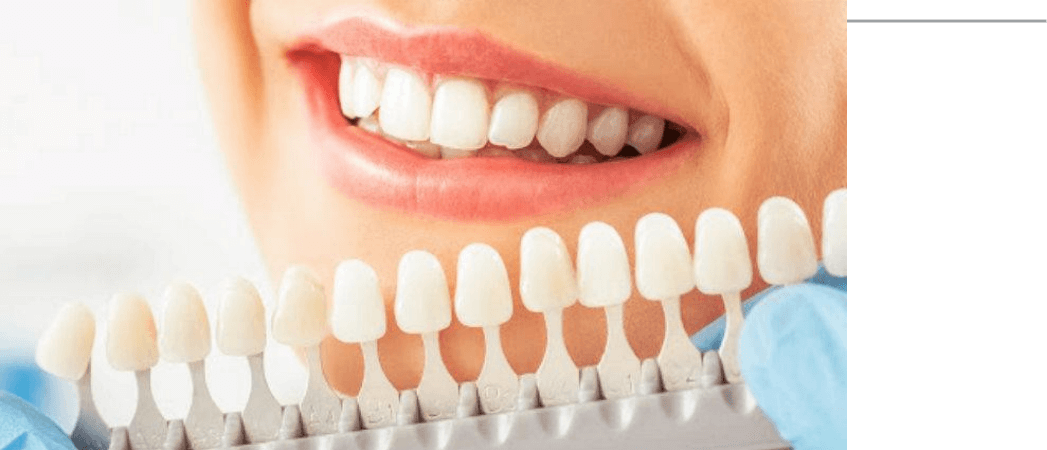 dental crowns near me