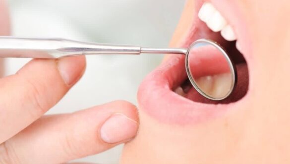 Caring for Your Smile