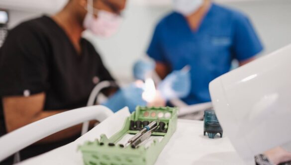 What Is a Composite Build-Up?